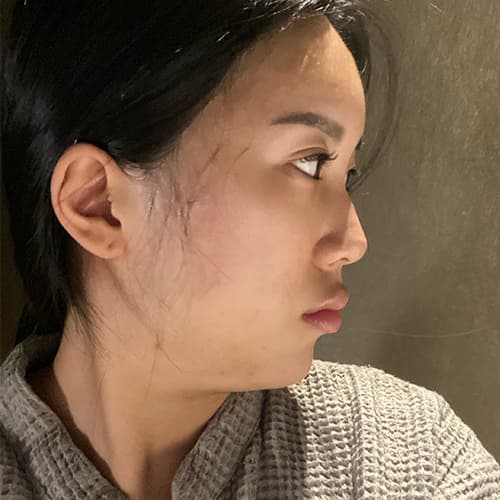 案例 3 第 4 張