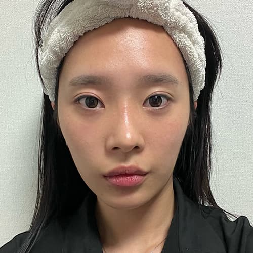 案例 6 第 2 張