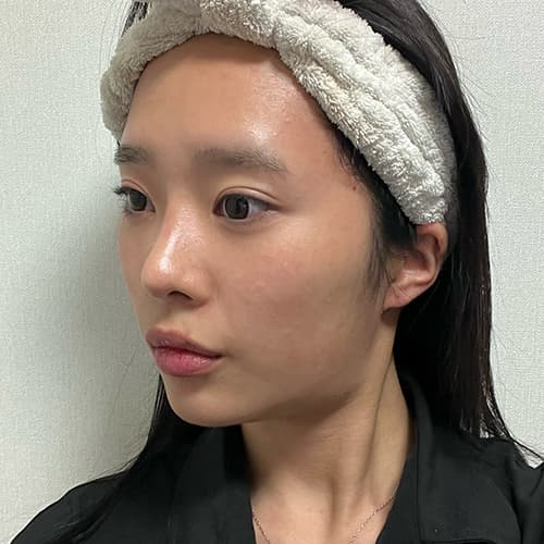 案例 6 第 4 張