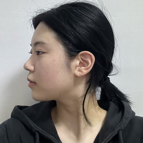 案例 9 第 4 張
