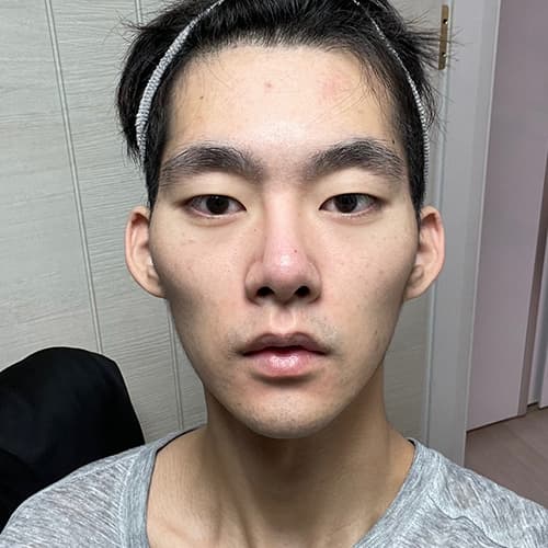 案例 13 第 2 張
