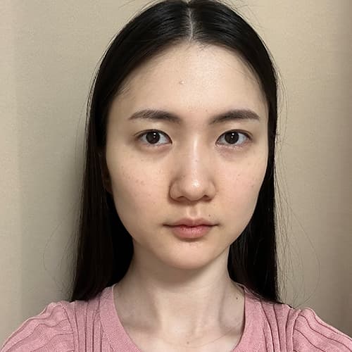 案例 8 術前