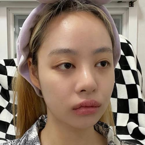 案例 22 第 3 張