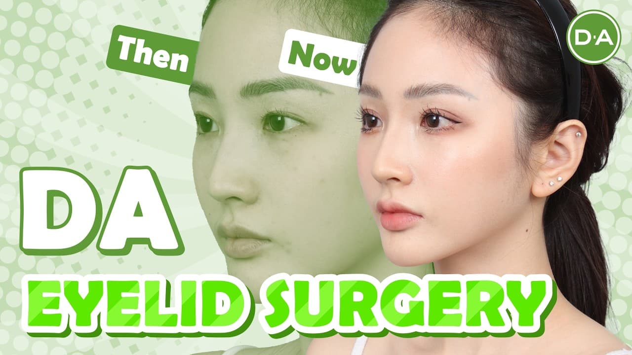 The Glow-Up After Double Eyelid Surgery