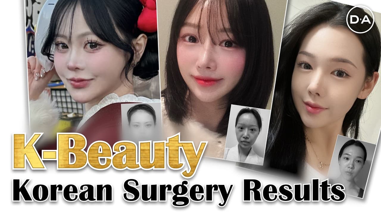 Korean Plastic Surgery Results ✨ K-Beauty, Refined.