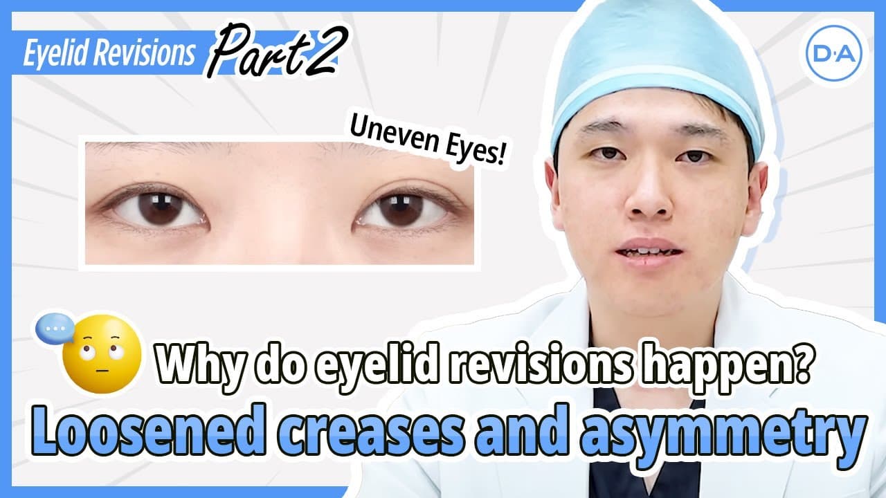 [DA Plastic Surgery Korea] Loosened Creases and Asymmetry Eyes PART 2