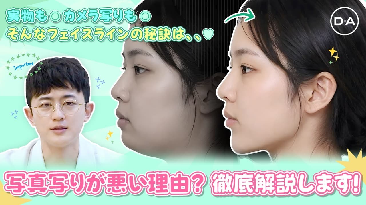 ［韓国整形］写真写りが悪い理由はフェイスライン？理由を徹底解説します！［DA美容外科］