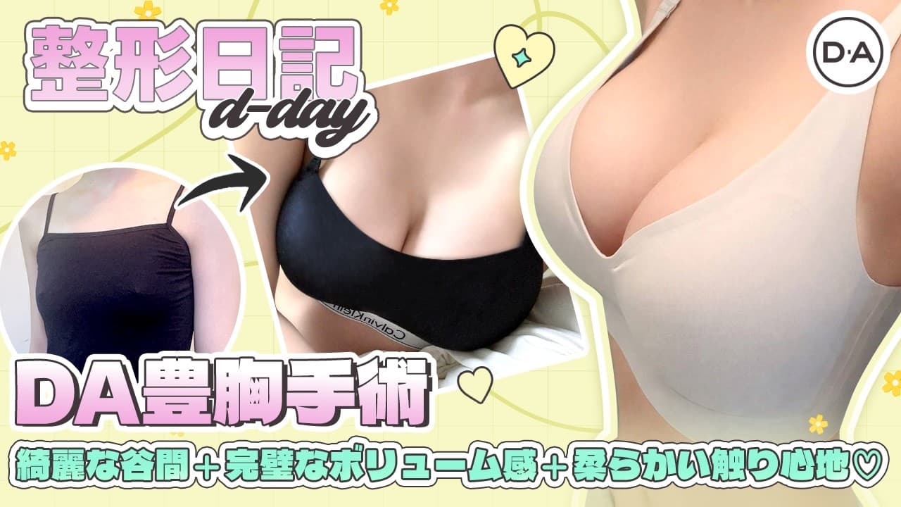 ［韓国整形］綺麗な谷間と完璧なボリューム感ある胸元！触り心地の良さまで抜群♪DA豊胸v-log［DA美容外科］