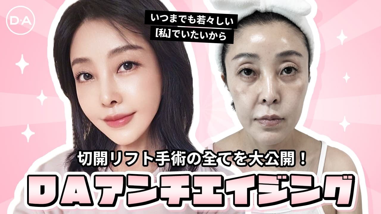 ［韓国整形］切開リフトでいつまでも若々しい私をキープ！DAアンチエイジング［DA美容外科］