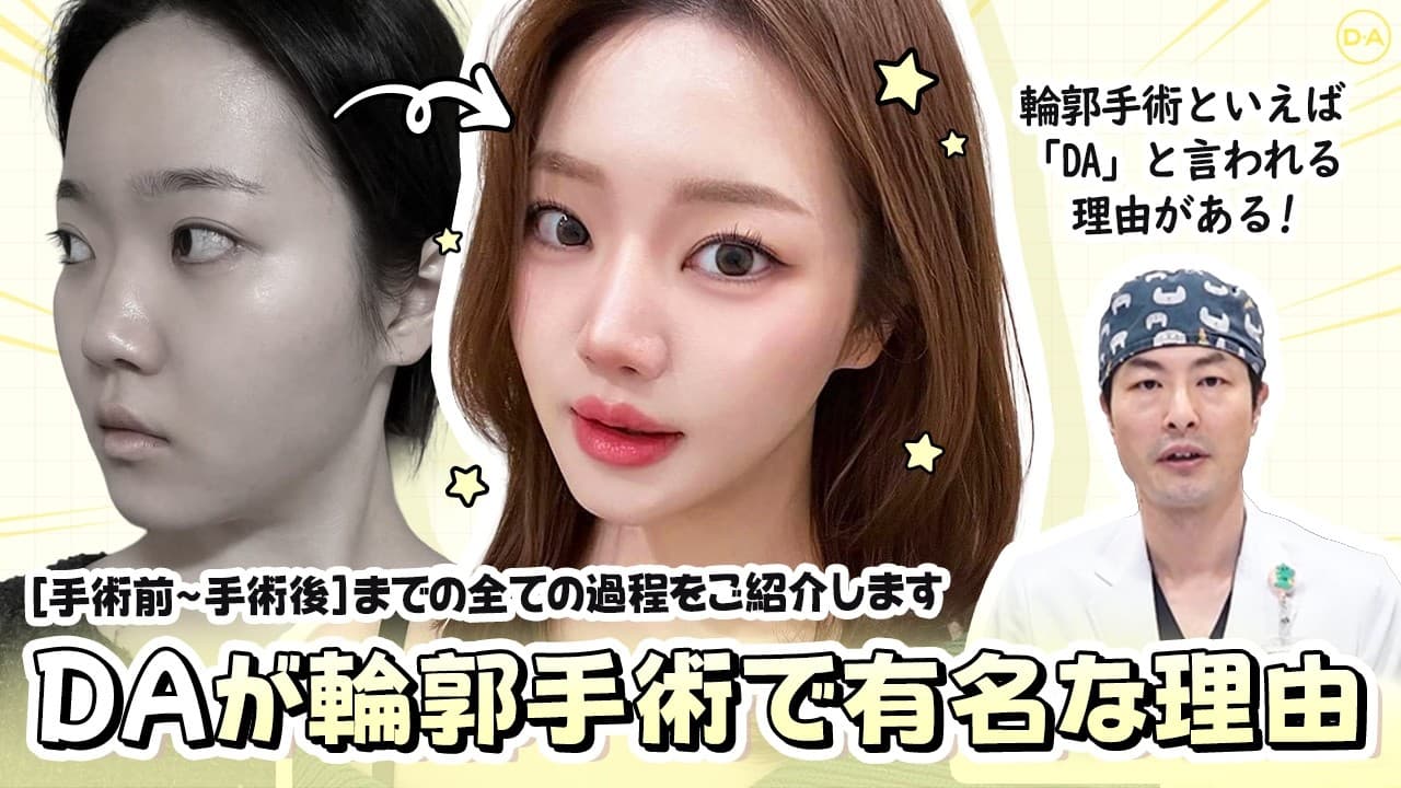 ［韓国整形］DAといえば輪郭手術と言われる理由は？手術前から手術後までの全過程をご紹介します！［DA美容外科］