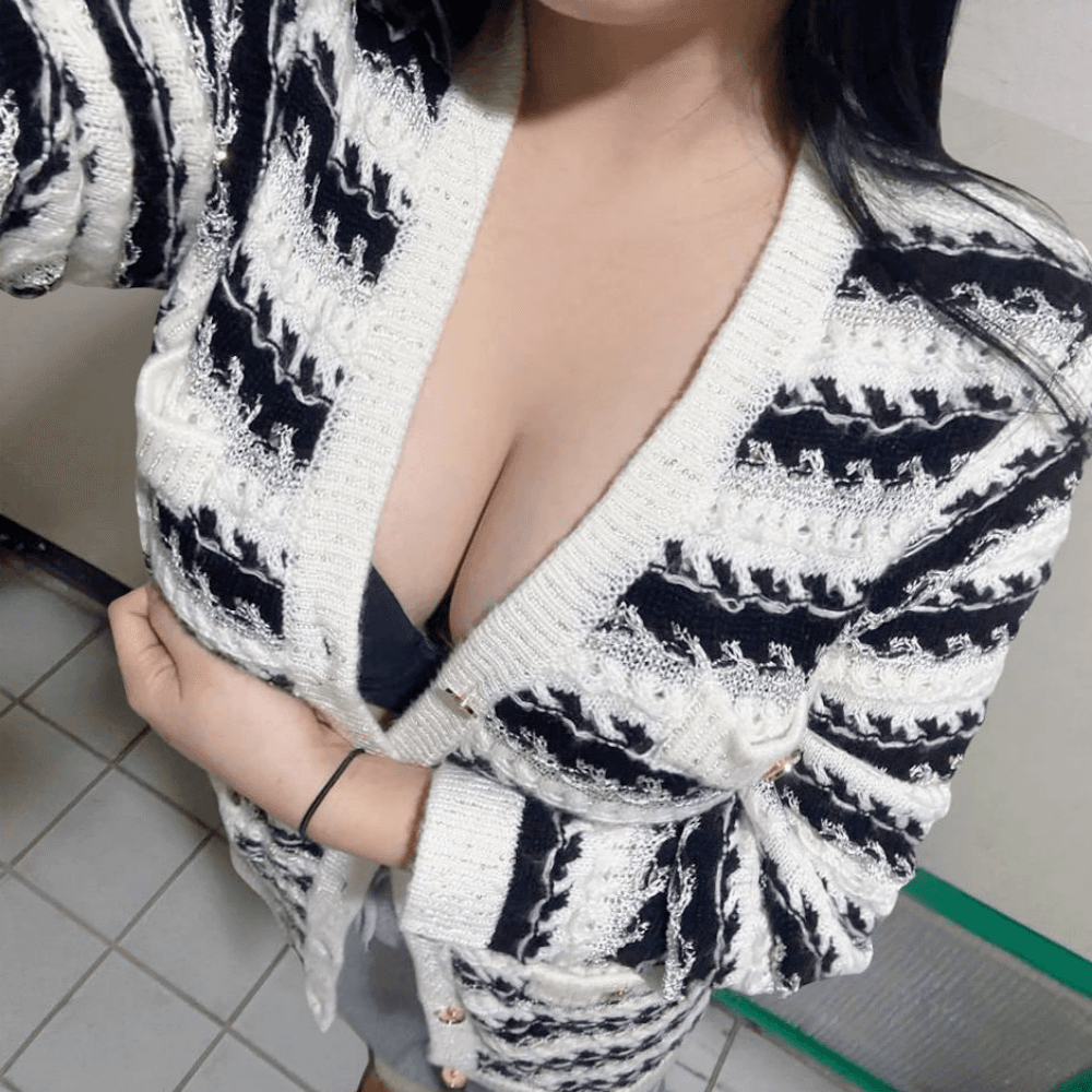 真實客人術後自拍 2