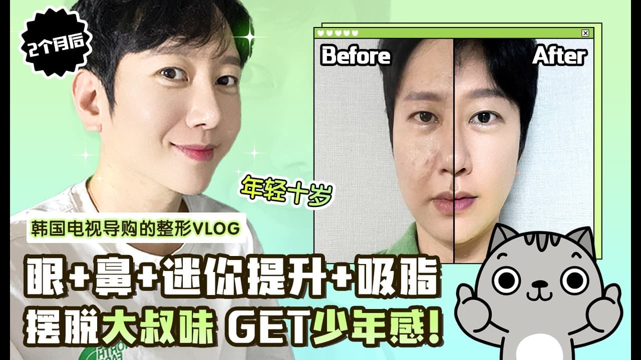 [韓國DA整形] 眼+鼻+迷你提升+抽脂 摆脱大叔味，GET少年感！！—韓國电视导購的整形VLOG!!!
