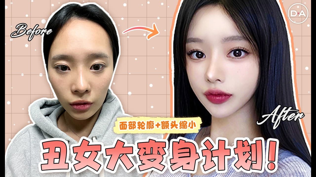 【韓國DA整形】丑女大變身计划！！！——面部輪廓 & 額頭縮小