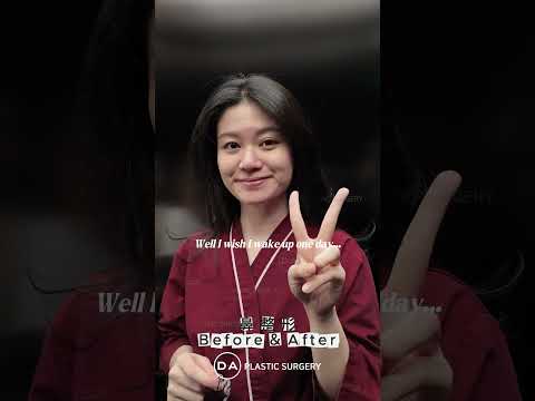 ［韓国整形］DA鼻整形で洗礼された印象へと改善🫶🏻［DA美容外科］
