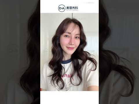 ［韓国整形］10歳以上も若返るDA切開リフトでここまで美しく🥹💜［DA美容外科