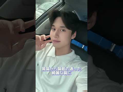 ［韓国整形］男らしい鼻でイケメンに変身💙メンズ整形もDA［DA美容外科