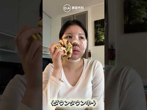 ［韓国整形］DA輪郭手術＆鼻整形で垢抜け✨［DA美容外科