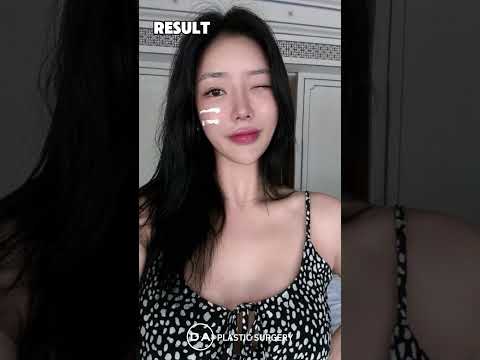 ［韓国整形］両顎輪郭、鼻、目、豊胸、アンチエイジング✨同時手術が可能なＤＡ［DA美容外科
